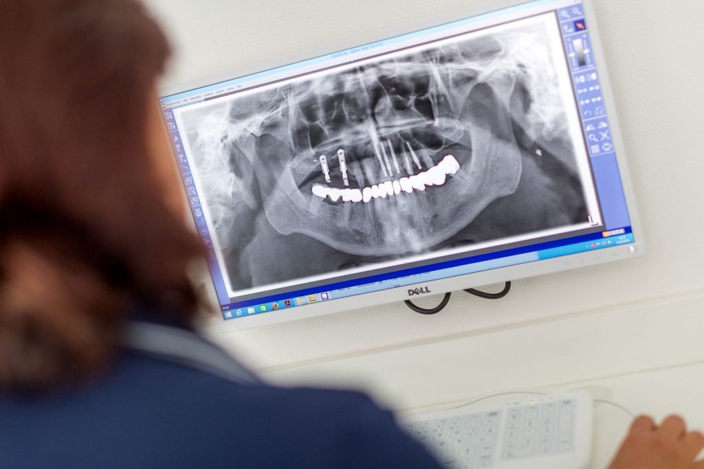Bildschirm zeigt Röntgenbild eines menschlichen Kiefers